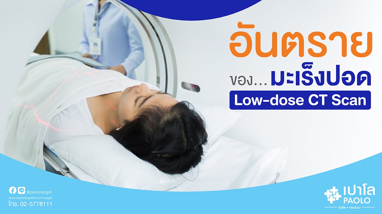 ป้องกันมะเร็งปอดด้วย Low Dose CT Scan 